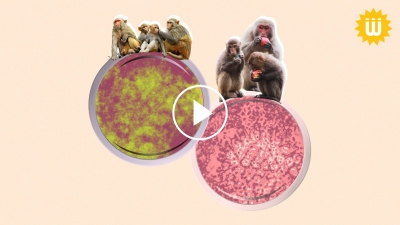 الفيروس الجديد.. أعراض "جدري القردة"
